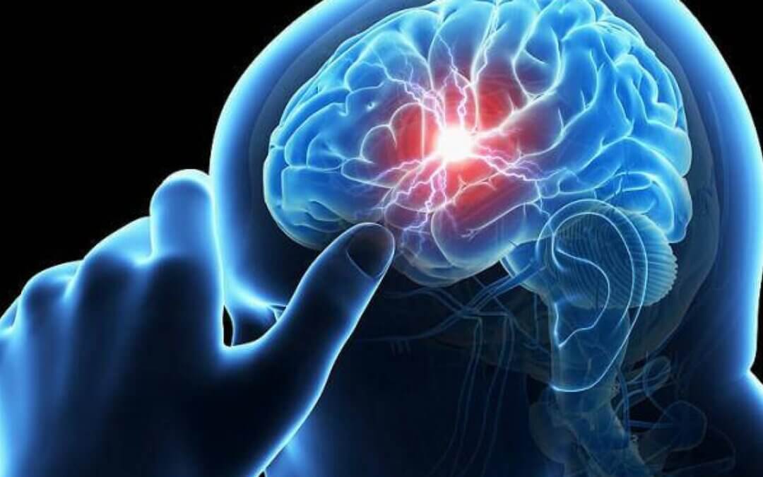Egy új tanulmány a Covid-19-et az egészséges fiatal betegek stroke-jához köti Egy új tanulmány a Covid-19-et az egészséges fiatal betegek stroke-jához köti